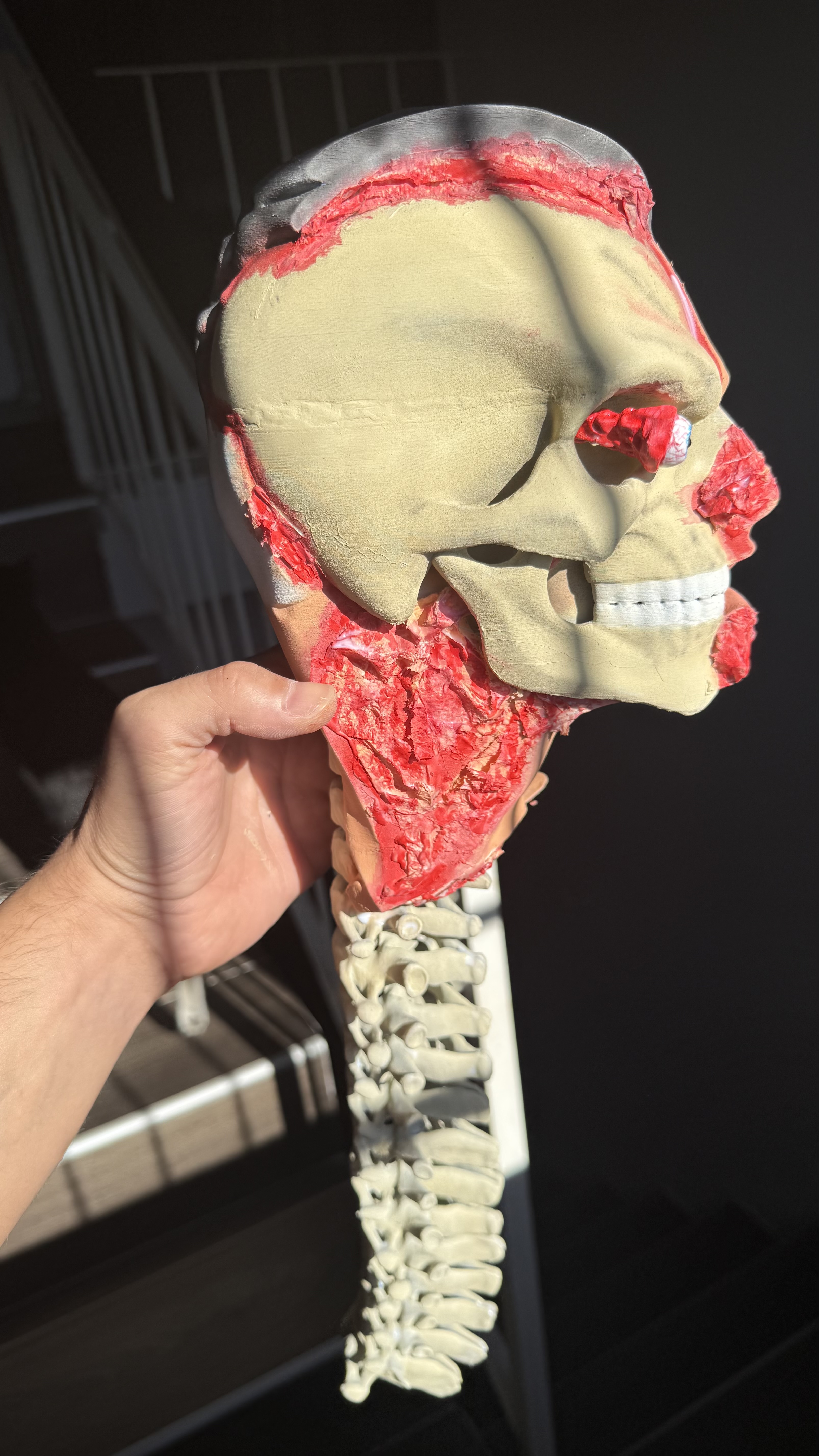 Fatality…